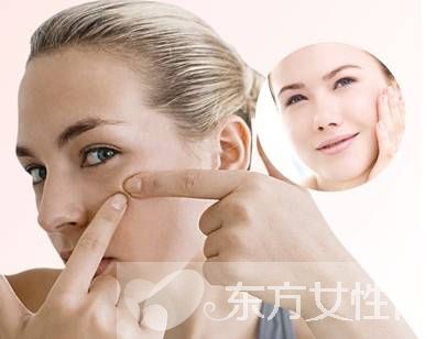 长痘痘不能吃什么 这4种食物千万别碰