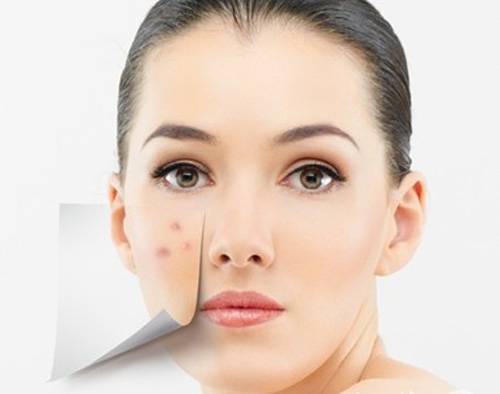 揭右脸长痘痘原因 三小妙招还你白嫩肌肤