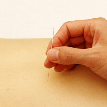 小编推荐 祛除雀斑 重塑无暇肌肤