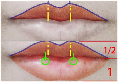 厚唇改薄 打造女明星完美微笑