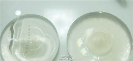 内视镜隆乳平胸女孩的福音