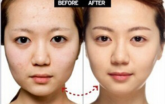 消浮肿瘦脸的偏方 荷叶薏仁面膜去水肿