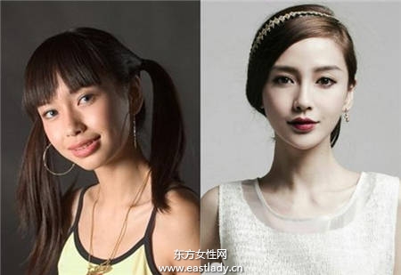 整容手术以改善咬合不正下颚突出 明星也这样做