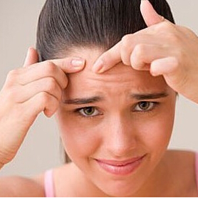 青春期如何祛痘 青春期的烦恼祛痘小绝招