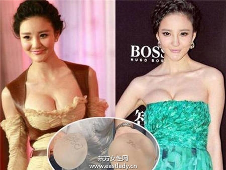 隆胸没啥了不起 但这些女星隆胸后还死不承认