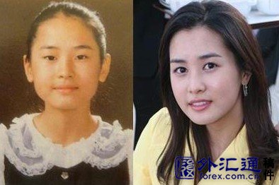 尹恩惠个人资料介绍 尹恩惠整容前后对比照片 尹恩惠电视剧