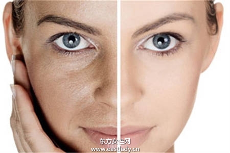 低成本摆脱皱纹  4个眼部抗皱妙招打击女人最大天敌