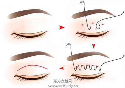 整形没什么不好 日本男人最能够接受女友整形的3个部位
