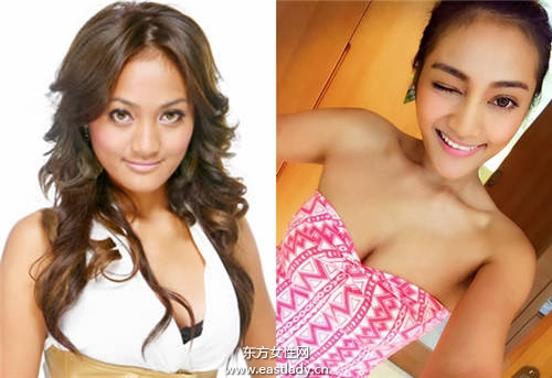 明星最爱的3种常见而且最能够突显五官的整形方法