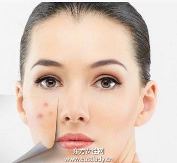 痊疮皮肤的饮食调理法