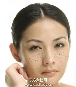 美白祛斑找准 病源  从内部下手