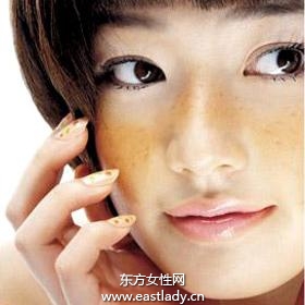 内外部因素诱发色斑产生