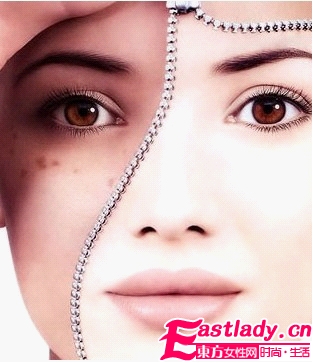 黄褐斑的形成及病理变化