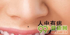 不能留在脸上的9颗痣