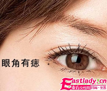 不能留在脸上的9颗痣