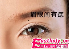 不能留在脸上的9颗痣