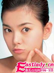 祛痘不留痕的五个原则