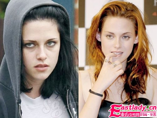 望闻问切 4步祛晒伤暗沉黑眼圈