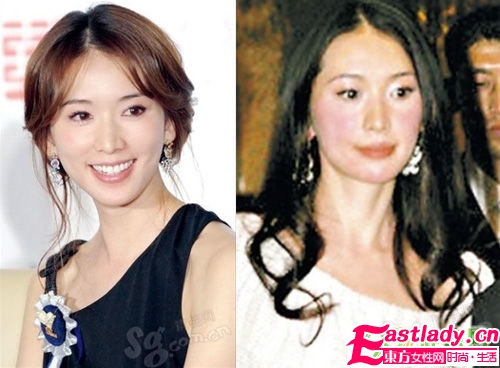 望闻问切 4步祛晒伤暗沉黑眼圈