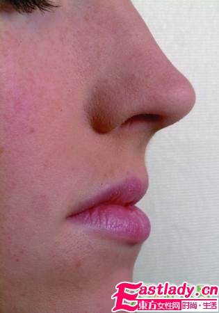 五官保养小窍门 让你年轻十岁