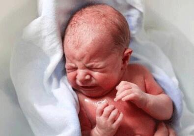 白色糠疹是什么 白色糠疹的病发原因是什么