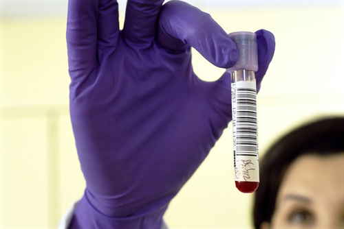 乙肝两对半是什么 乙肝两对半检查对照表