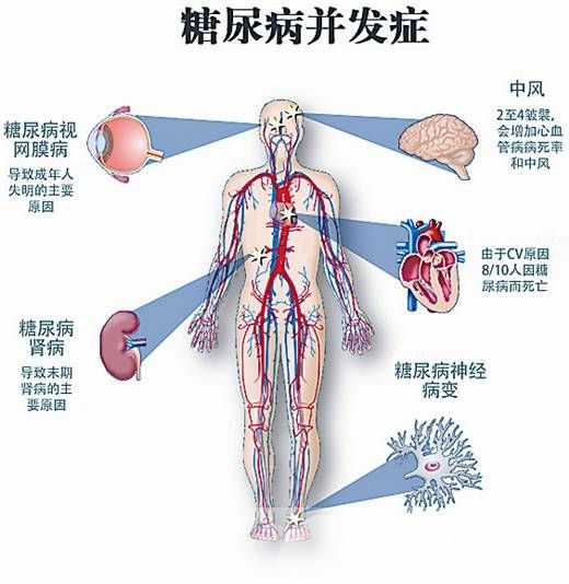 糖尿病肾病的早期症状 这些食疗方法真的很管用哦