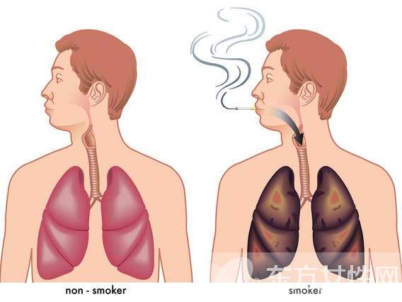 肺气肿会传染吗 治疗肺气肿的食疗偏方推荐