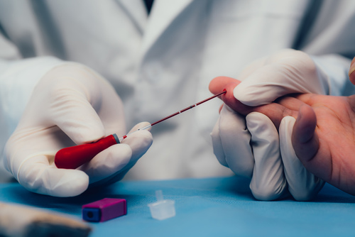 乙肝两对半是什么 乙肝两对半检查对照表