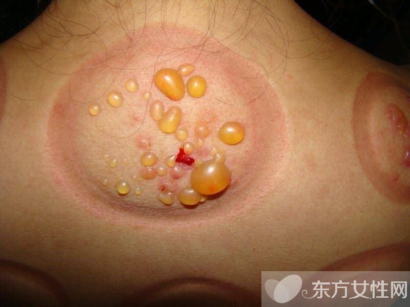 身体湿气重怎么调理 湿气重的主要表现有哪些