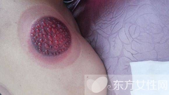 身体湿气重怎么调理 湿气重的主要表现有哪些