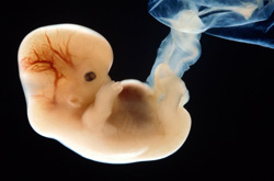 流产的症状有哪些 有什么预防措施