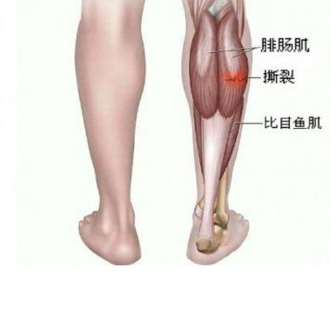 不伤害膝关节 腿部肌肉锻炼最简单的方法