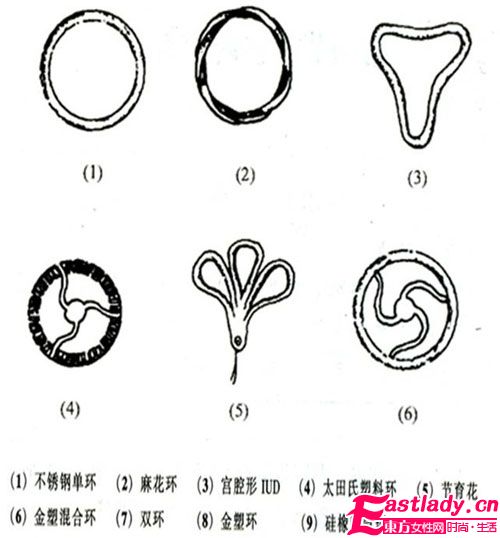 各种节育环的种类图片介绍