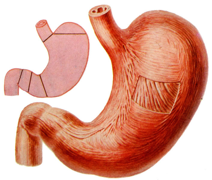 胃热的症状有哪些 日常生活中该如何注意