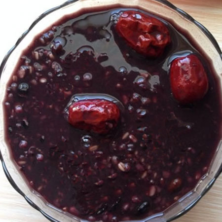 贫血有哪些症状 贫血需要注意些什么