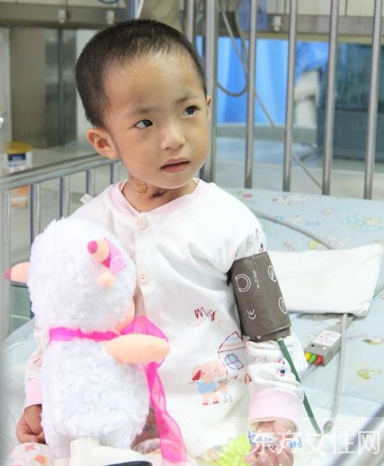 先天性心脏病的症状表现 这些护理常识非常重要哦