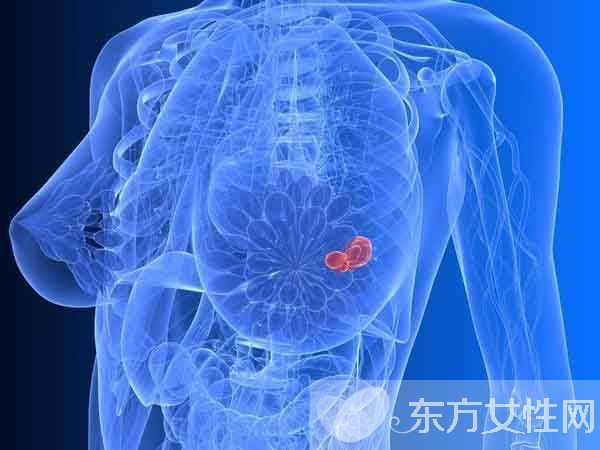 乳腺病乳腺增生症状表现 这些食物尽量少吃哦