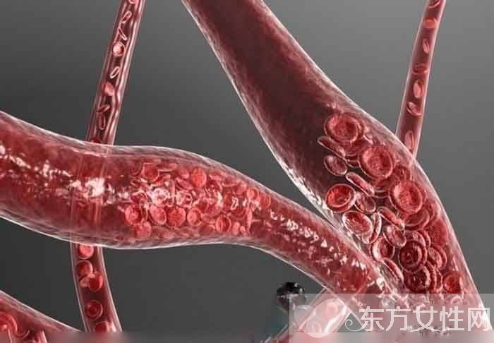 心脑血管疾病有哪些 日常饮食这些方面一定要注意