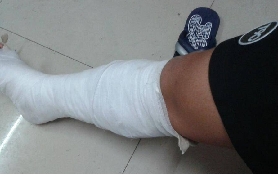 骨折愈合时间需要多久 愈合康复训练