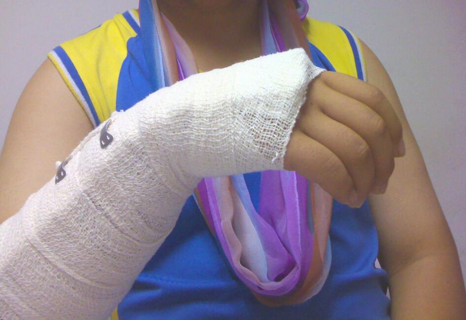 骨折愈合时间需要多久 愈合康复训练