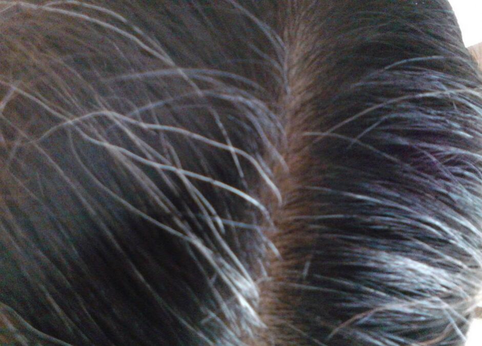 头发变白形成原因 看哪些你已中招