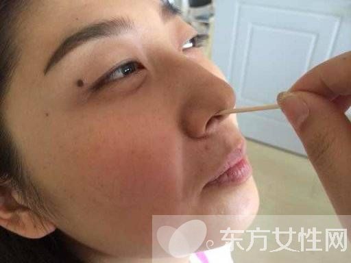 慢性鼻炎的症状有哪些 这些食疗方法用过的都说好