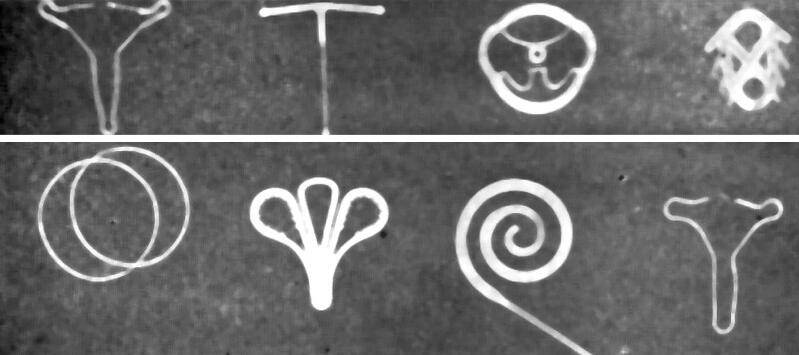 避孕环的原理有哪些 告诉你上环后的注意事项