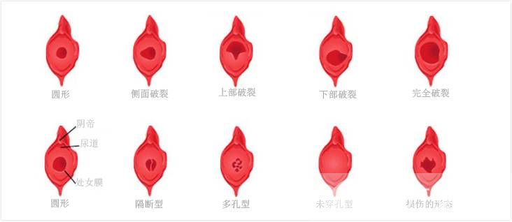 女性阴道生殖器构造图片 女性的阴道到底有多深