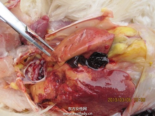 中度脂肪肝的治疗方法 饮食调理有妙招