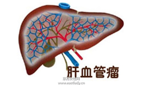 肝囊肿是怎么形成的 应该注意哪方面的饮食习惯