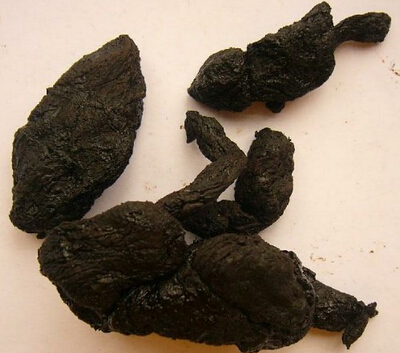 中医养生 需了解的养肾保健知识