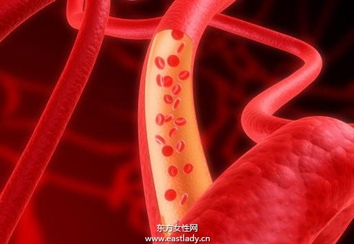 毛细血管破裂是怎么回事 揭秘毛细血管破裂的症状