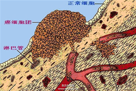 喝热水排毒还可抗癌